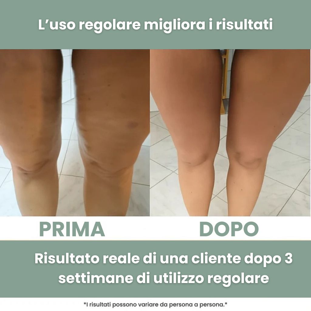 Rullo Massaggiante Anti-Cellulite Florema™