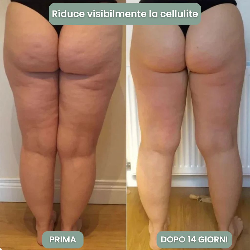 Rullo Massaggiante Anti-Cellulite Florema™