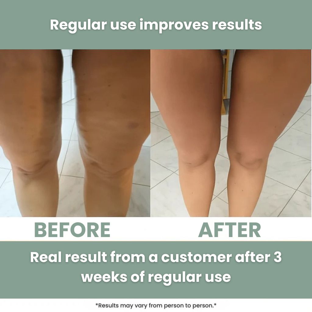 Anti-Cellulite Massage Roller Florema™